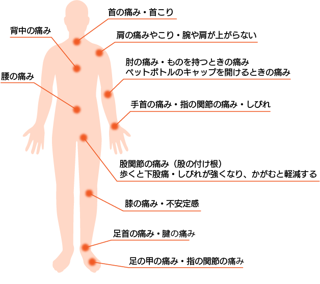 痛みの部位のイラスト：首の痛み・首こり、肩の痛みやこり・腕や肩が上がらない、肘の痛み・ものを持つときの痛み、ペットボトルのキャップを開けるときの痛み、手首の痛み・指の関節の痛み・しびれ、股関節の痛み（股の付け根）歩くと下股痛・しびれが強くなり、かがむと軽減する、膝の痛み・不安定感、膝の痛み・不安定感、足首の痛み・腱の痛み、足の甲の痛み・指の関節の痛み、背中の痛み、腰の痛み